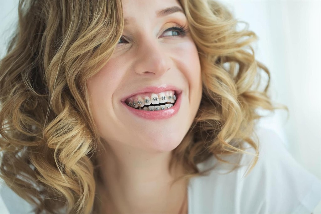 Brackets o Invisalign: ¿cuál es la mejor opción para corregir tu sonrisa?