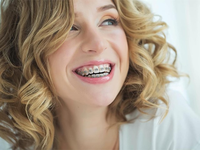 Brackets o Invisalign: ¿cuál es la mejor opción para corregir tu sonrisa?