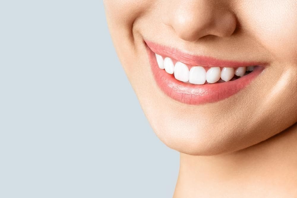 ¿Cuánto cuesta un procedimiento de blanqueamiento dental?