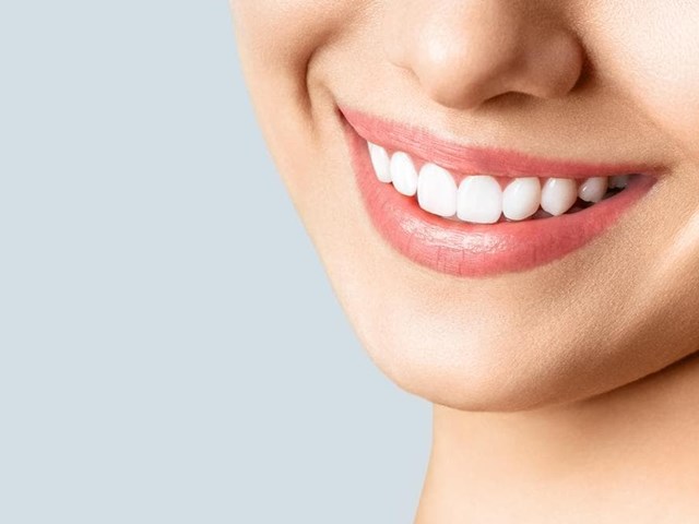 ¿Cuánto cuesta un procedimiento de blanqueamiento dental?
