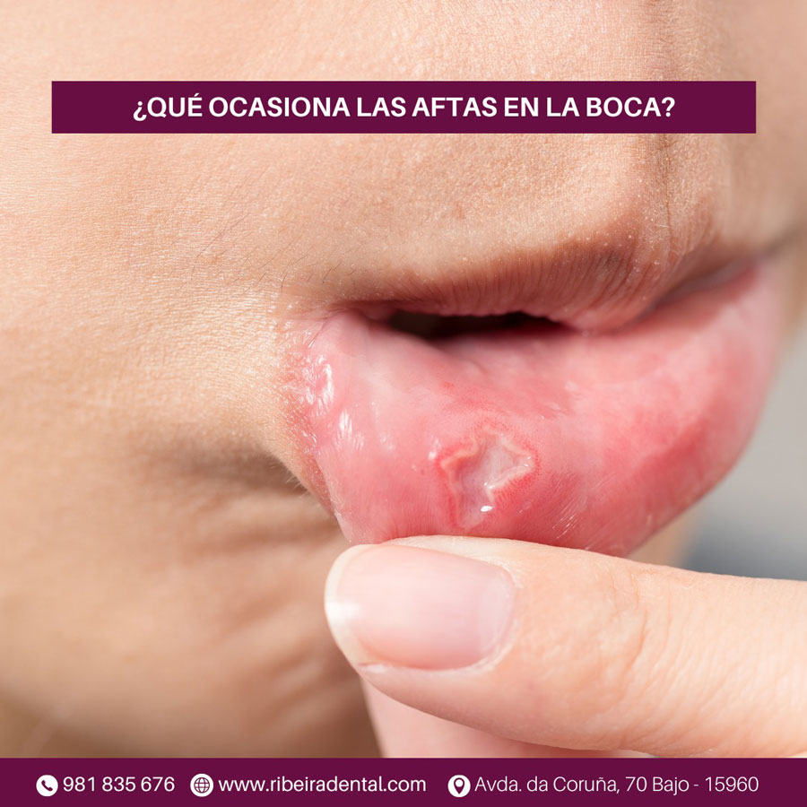 Visita nuestras redes sociales
